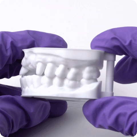 3D-gedruckte Zahnmodelle sind ein erschwingliches Hilfsmittel in der Zahnmedizin und Kieferorthopädie